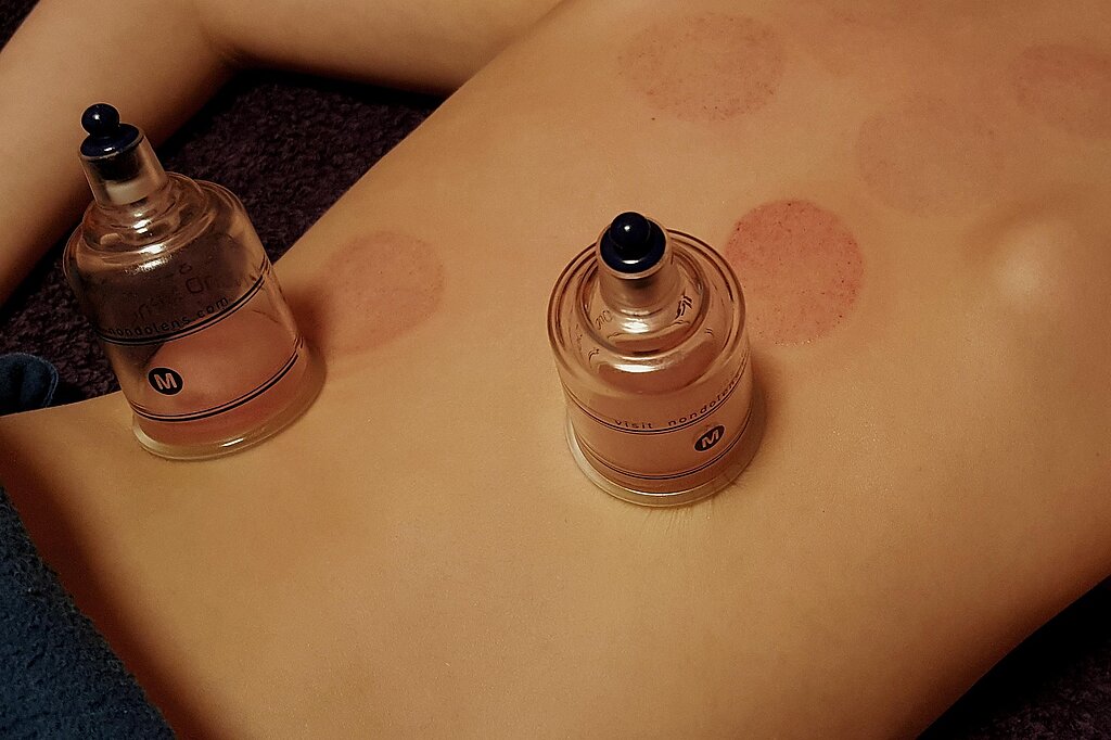 Entgiftungs- und Ausleitungsverfahren Freital